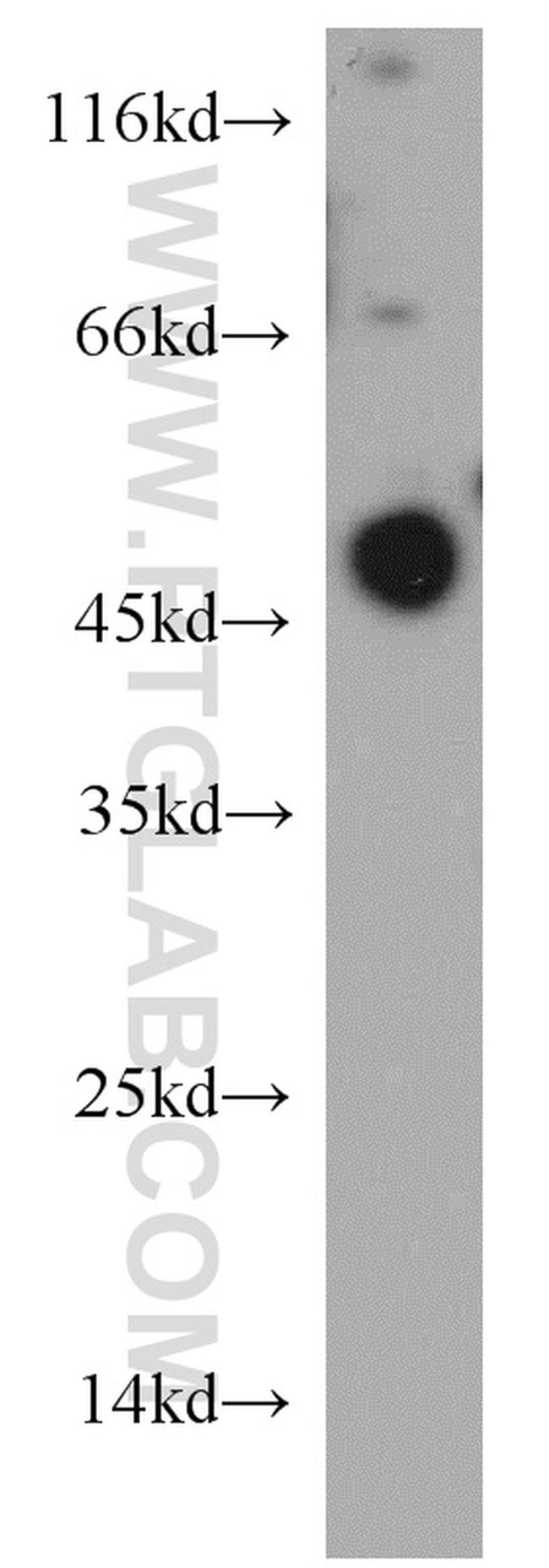 ZFYVE27 Antibody in Western Blot (WB)