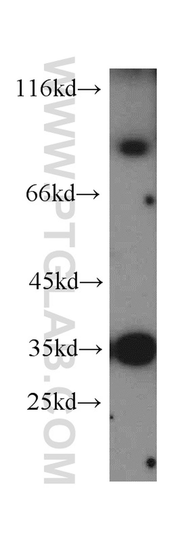 MUM1 Antibody in Western Blot (WB)