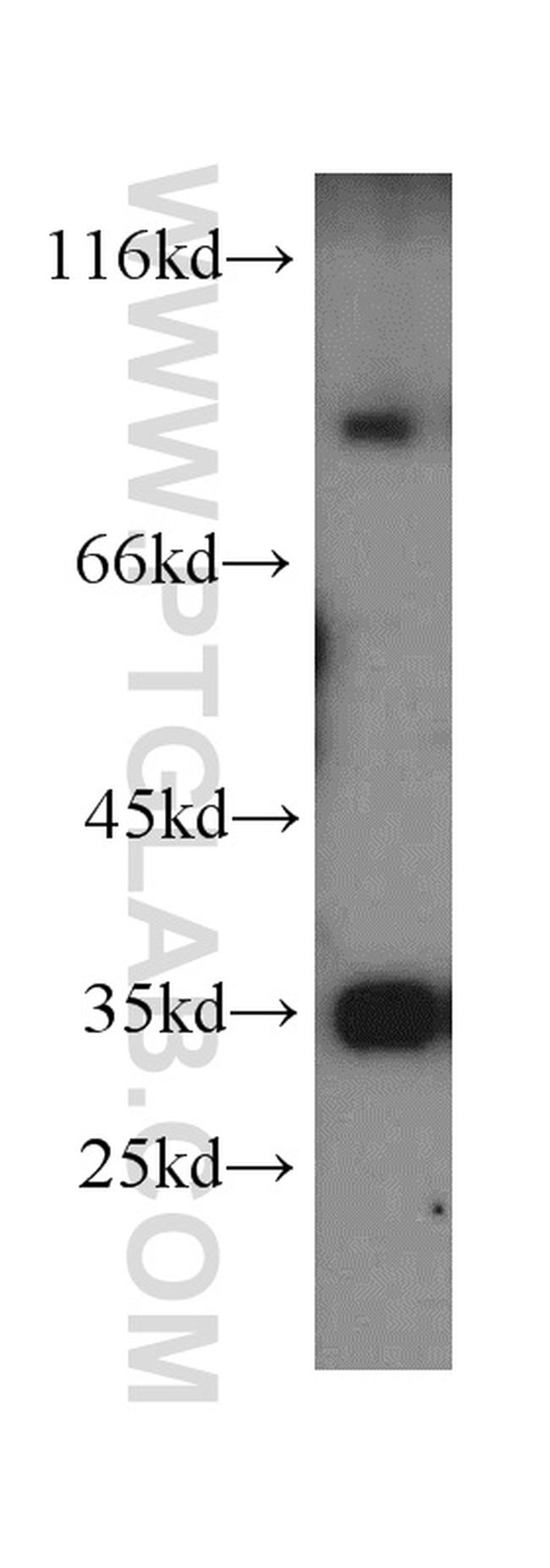 MUM1 Antibody in Western Blot (WB)