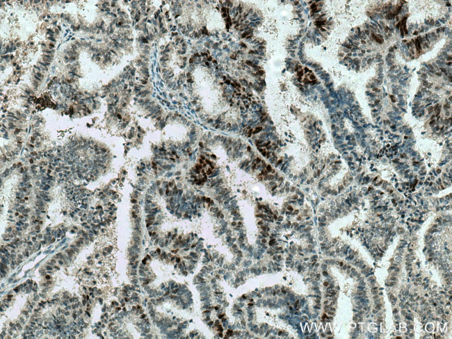 MAD2L2 Antibody in Immunohistochemistry (Paraffin) (IHC (P))