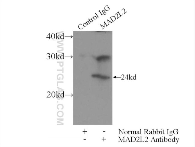 MAD2L2 Antibody in Immunoprecipitation (IP)