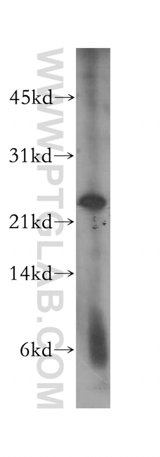 MAD2L2 Antibody in Western Blot (WB)