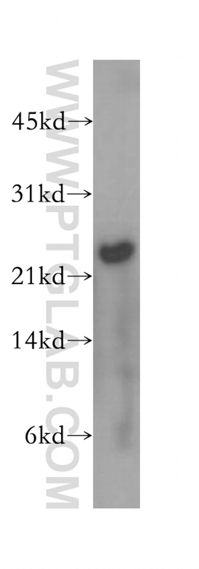 MAD2L2 Antibody in Western Blot (WB)