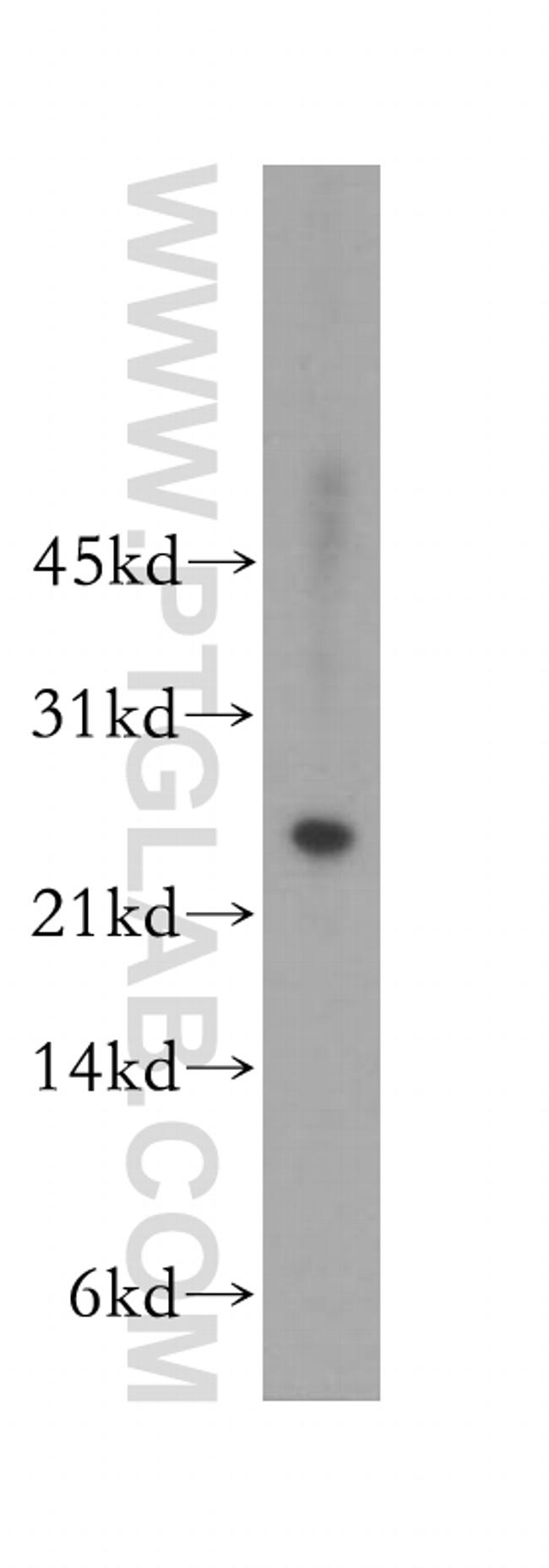 MAD2L2 Antibody in Western Blot (WB)