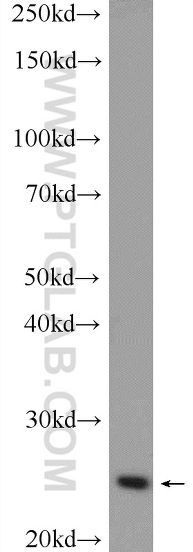 MAD2L2 Antibody in Western Blot (WB)