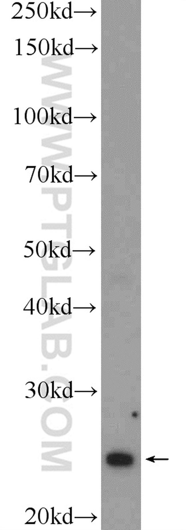 MAD2L2 Antibody in Western Blot (WB)