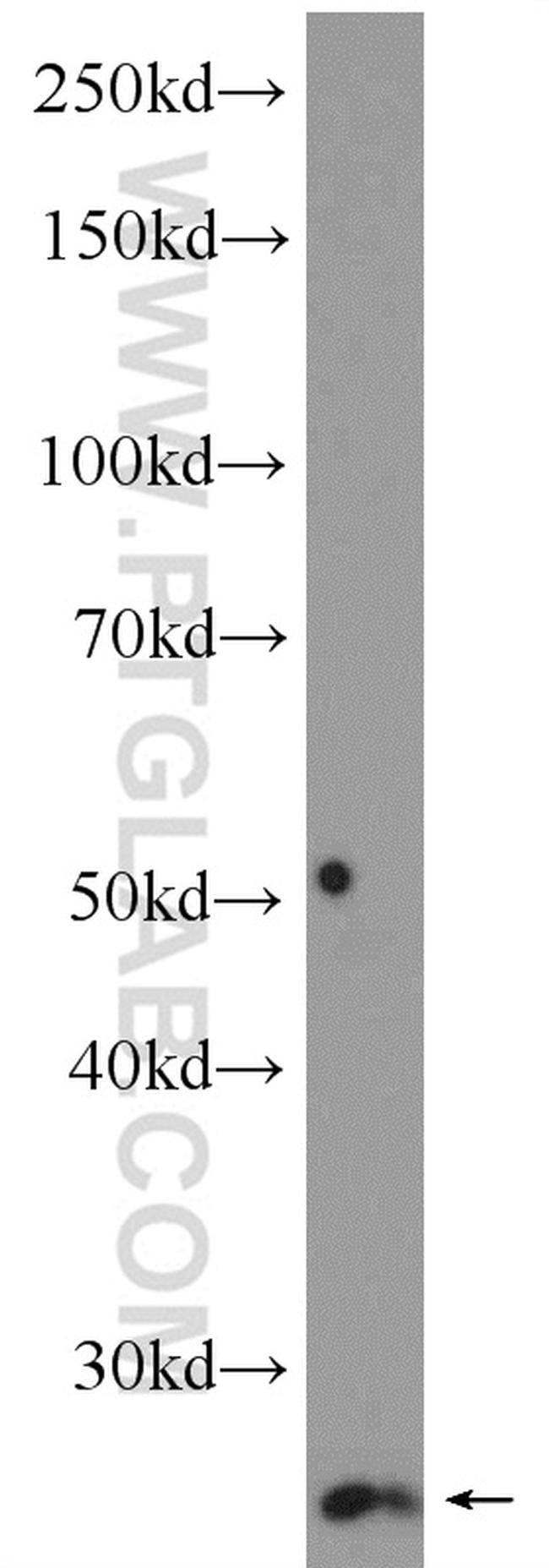 MAD2L2 Antibody in Western Blot (WB)