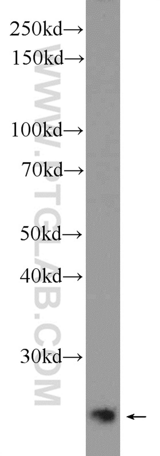 MAD2L2 Antibody in Western Blot (WB)