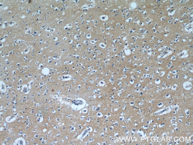 EAAT3 Antibody in Immunohistochemistry (Paraffin) (IHC (P))