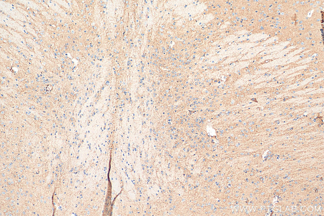 EAAT3 Antibody in Immunohistochemistry (Paraffin) (IHC (P))