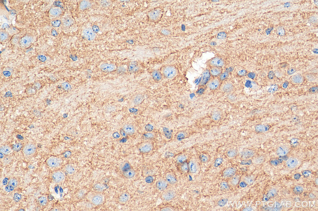 EAAT3 Antibody in Immunohistochemistry (Paraffin) (IHC (P))