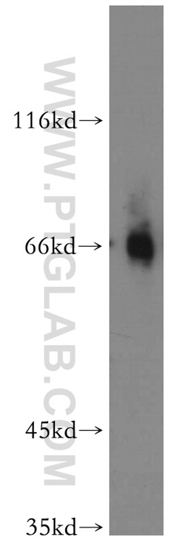 EAAT3 Antibody in Western Blot (WB)