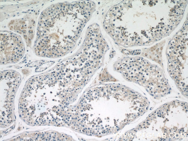 EAAT3 Antibody in Immunohistochemistry (Paraffin) (IHC (P))