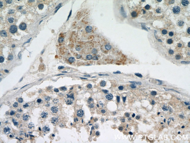 EAAT3 Antibody in Immunohistochemistry (Paraffin) (IHC (P))