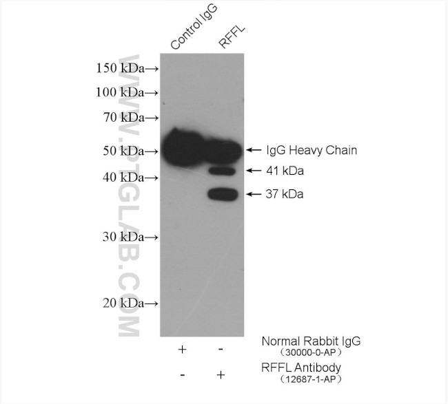 RFFL Antibody in Immunoprecipitation (IP)