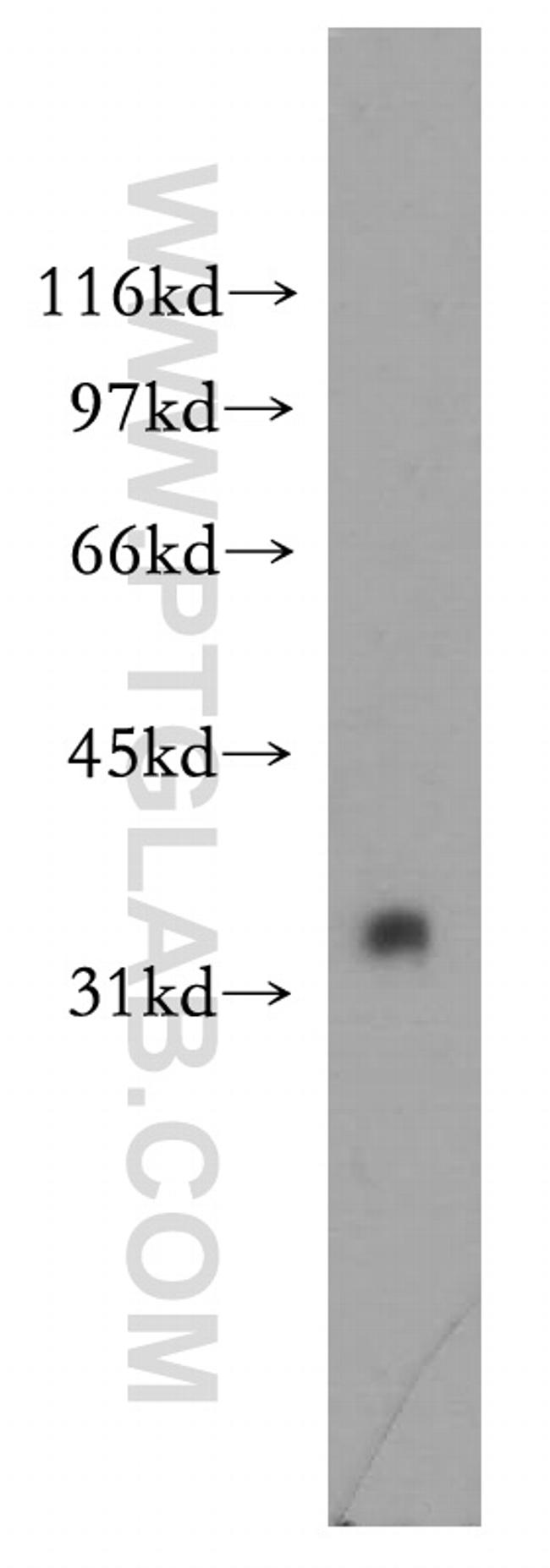 RFFL Antibody in Western Blot (WB)