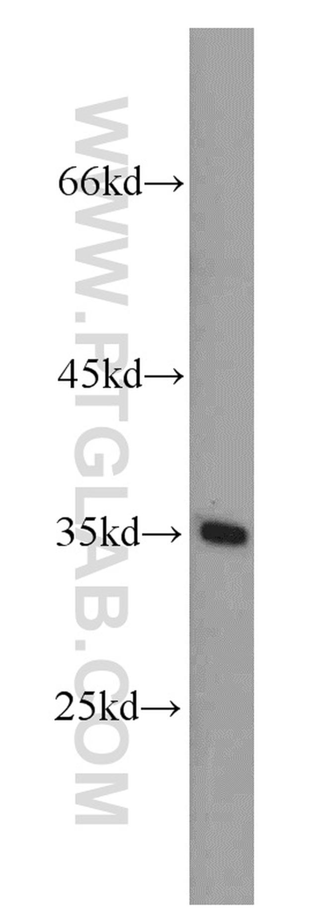 DPPA2 Antibody in Western Blot (WB)