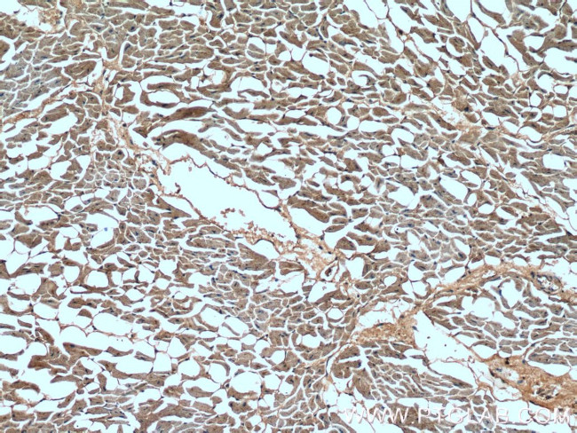 STK38L Antibody in Immunohistochemistry (Paraffin) (IHC (P))