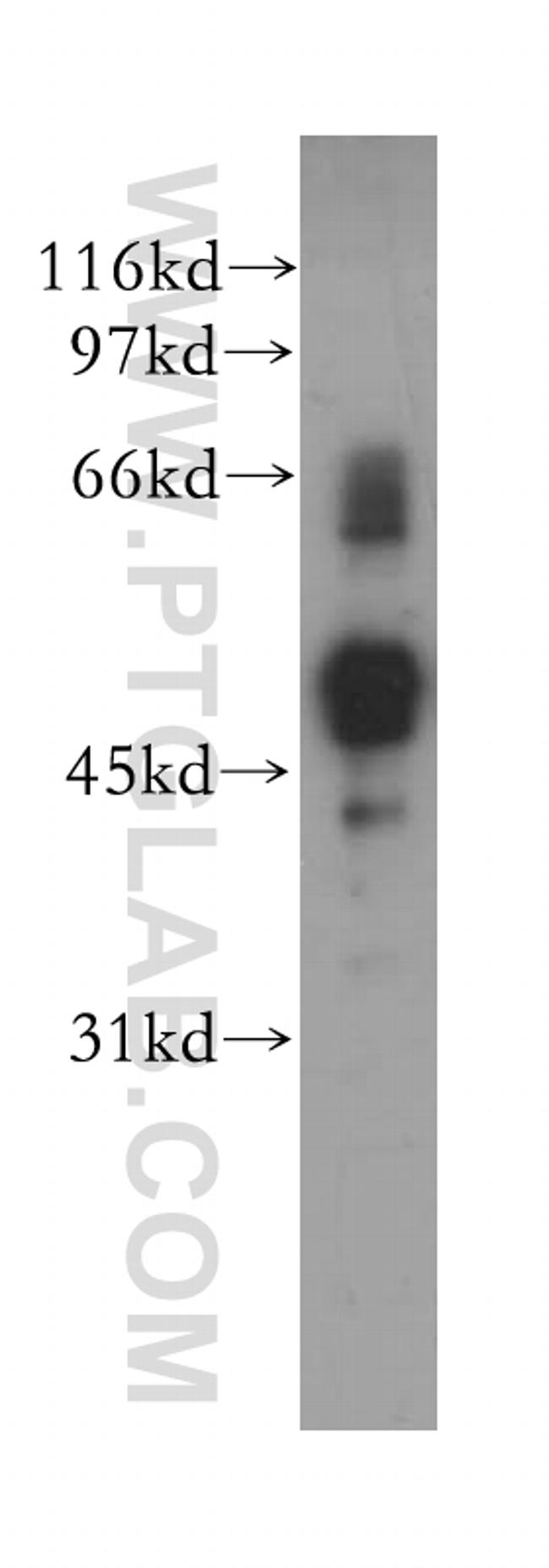 STK38L Antibody in Western Blot (WB)