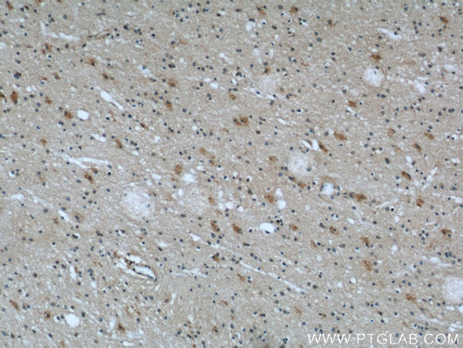 Kallikrein 11 Antibody in Immunohistochemistry (Paraffin) (IHC (P))