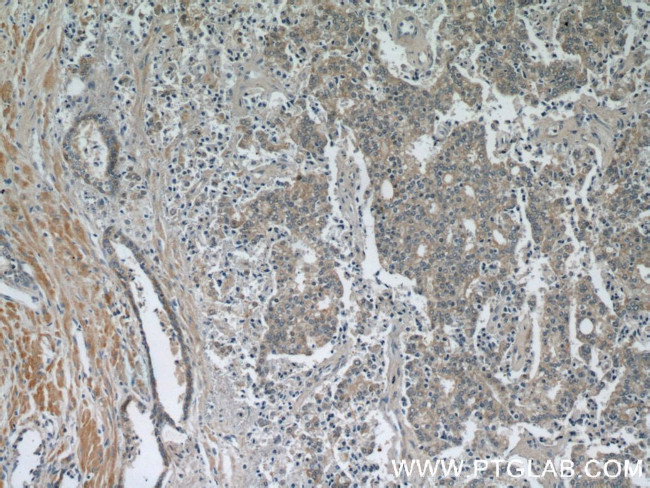 Kallikrein 11 Antibody in Immunohistochemistry (Paraffin) (IHC (P))