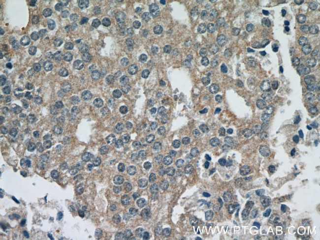 Kallikrein 11 Antibody in Immunohistochemistry (Paraffin) (IHC (P))