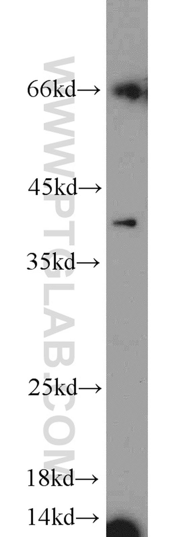 Kallikrein 11 Antibody in Western Blot (WB)