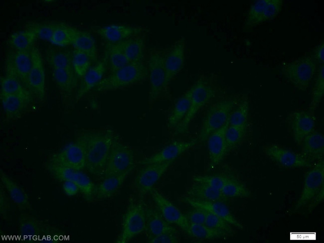 SGK3 Antibody in Immunocytochemistry (ICC/IF)