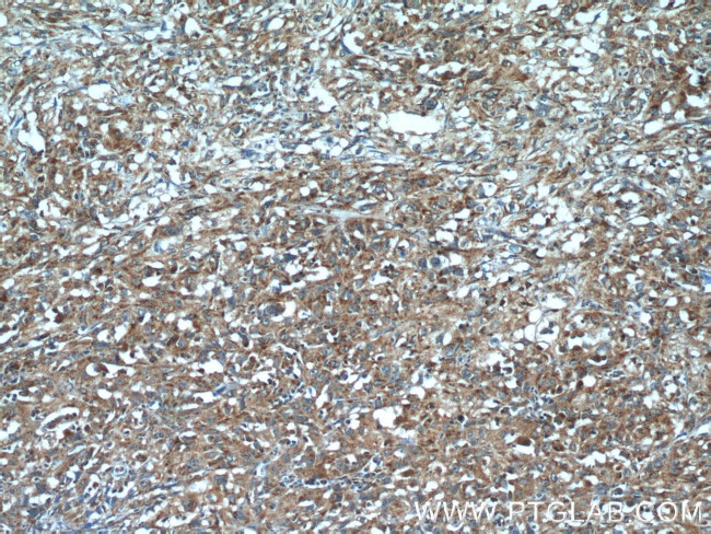 SGK3 Antibody in Immunohistochemistry (Paraffin) (IHC (P))