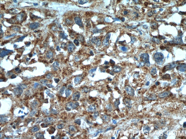 SGK3 Antibody in Immunohistochemistry (Paraffin) (IHC (P))