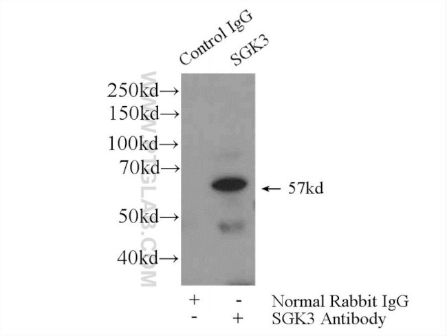 SGK3 Antibody in Immunoprecipitation (IP)