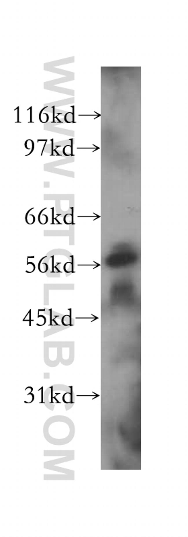 SGK3 Antibody in Western Blot (WB)