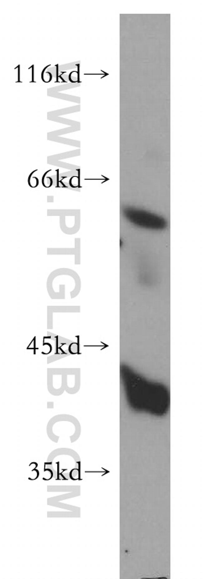 SGK3 Antibody in Western Blot (WB)