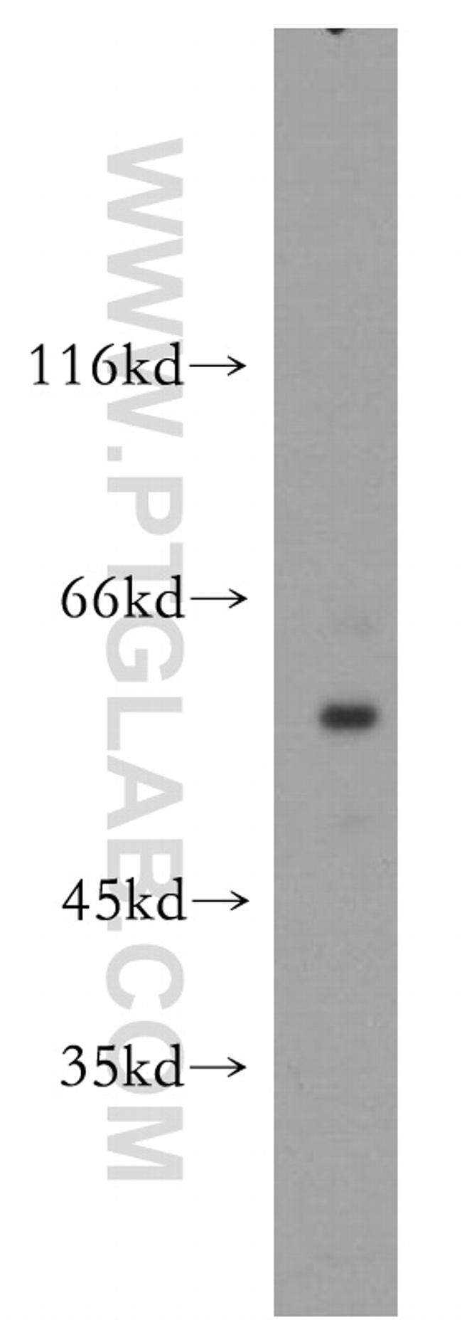 SGK3 Antibody in Western Blot (WB)