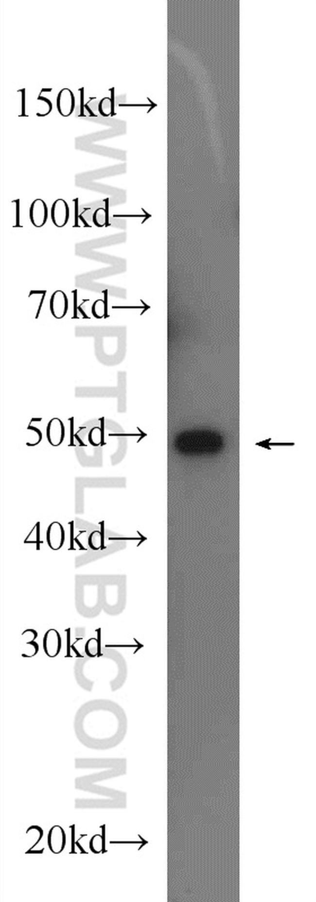 SGK3 Antibody in Western Blot (WB)