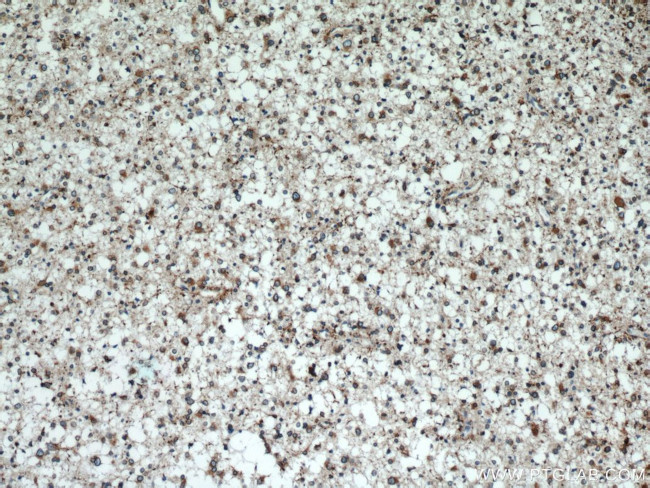 KIFAP3 Antibody in Immunohistochemistry (Paraffin) (IHC (P))