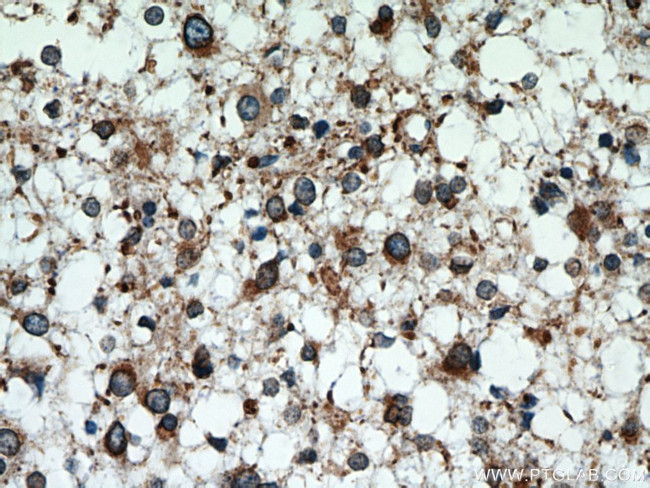 KIFAP3 Antibody in Immunohistochemistry (Paraffin) (IHC (P))