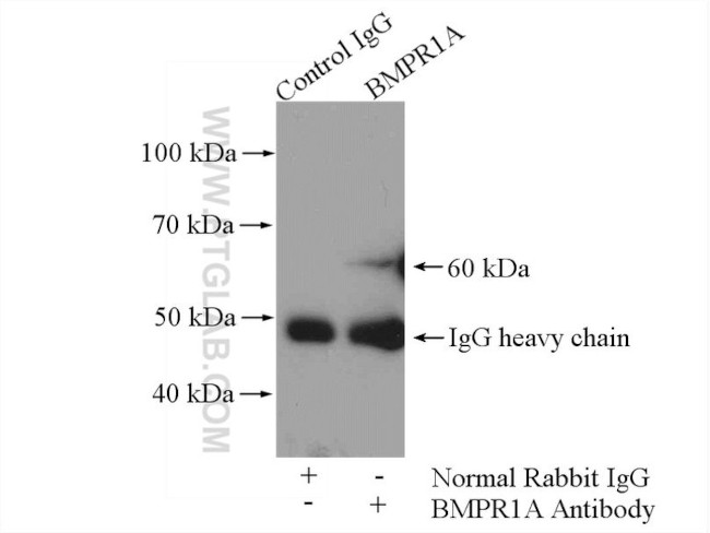 BMPR1A Antibody in Immunoprecipitation (IP)