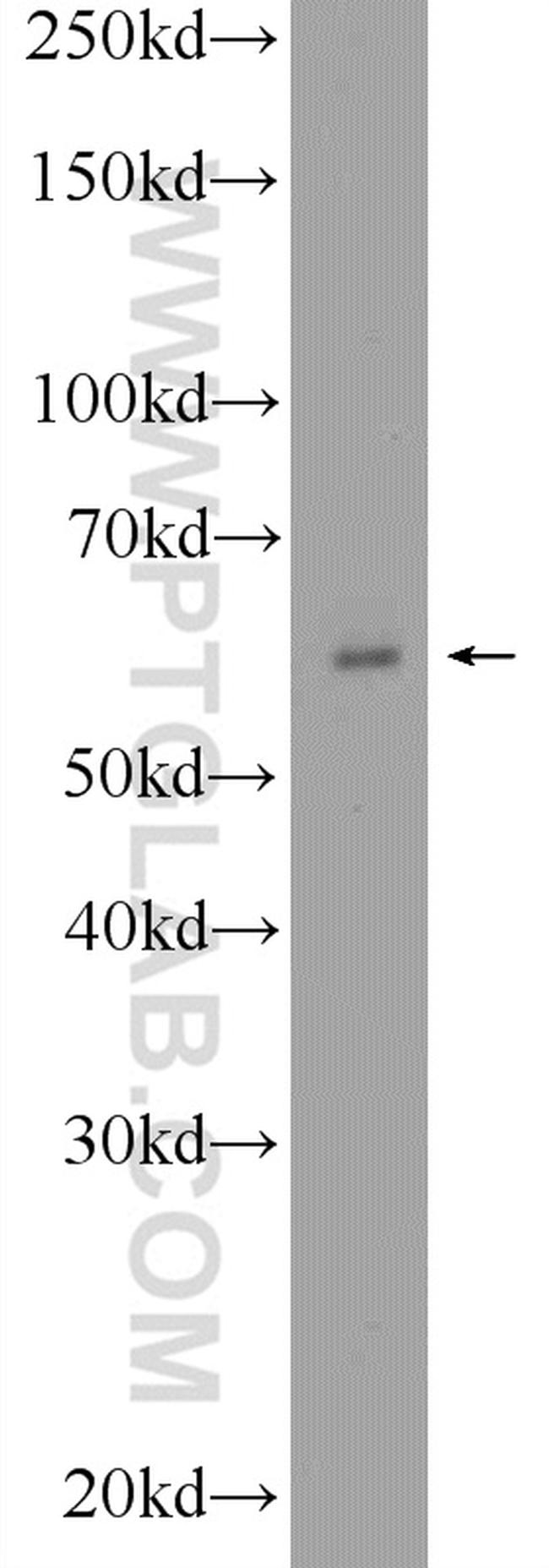 BMPR1A Antibody in Western Blot (WB)