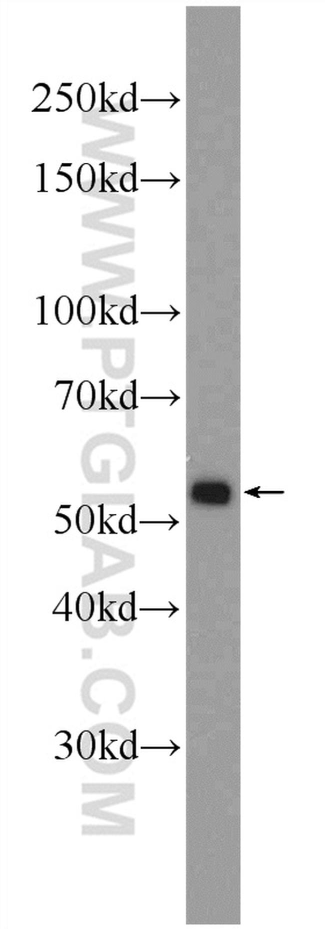 BMPR1A Antibody in Western Blot (WB)