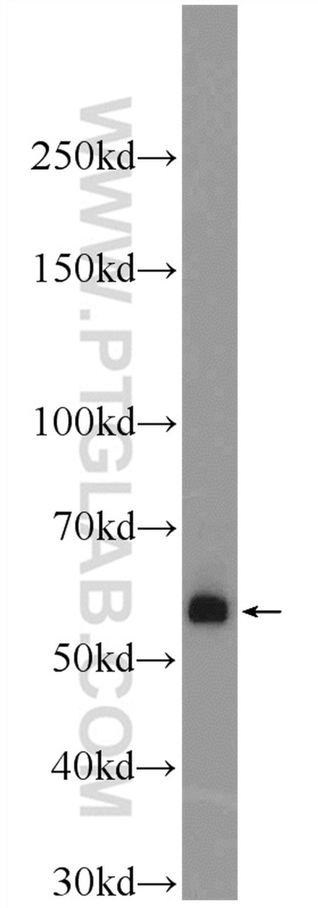 BMPR1A Antibody in Western Blot (WB)