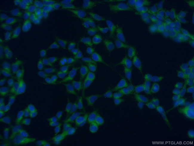 SNAP29 Antibody in Immunocytochemistry (ICC/IF)