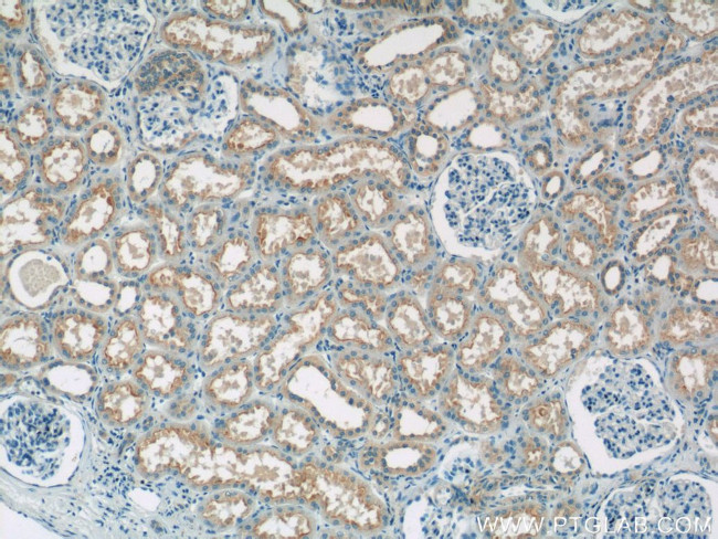 SNAP29 Antibody in Immunohistochemistry (Paraffin) (IHC (P))