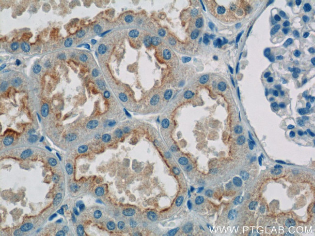 SNAP29 Antibody in Immunohistochemistry (Paraffin) (IHC (P))