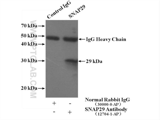 SNAP29 Antibody in Immunoprecipitation (IP)