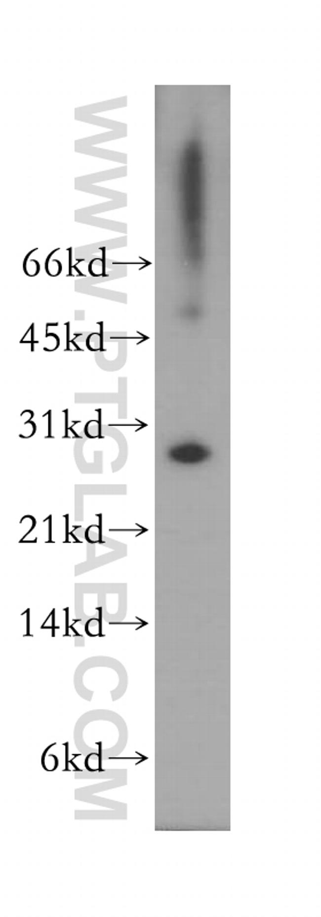 SNAP29 Antibody in Western Blot (WB)
