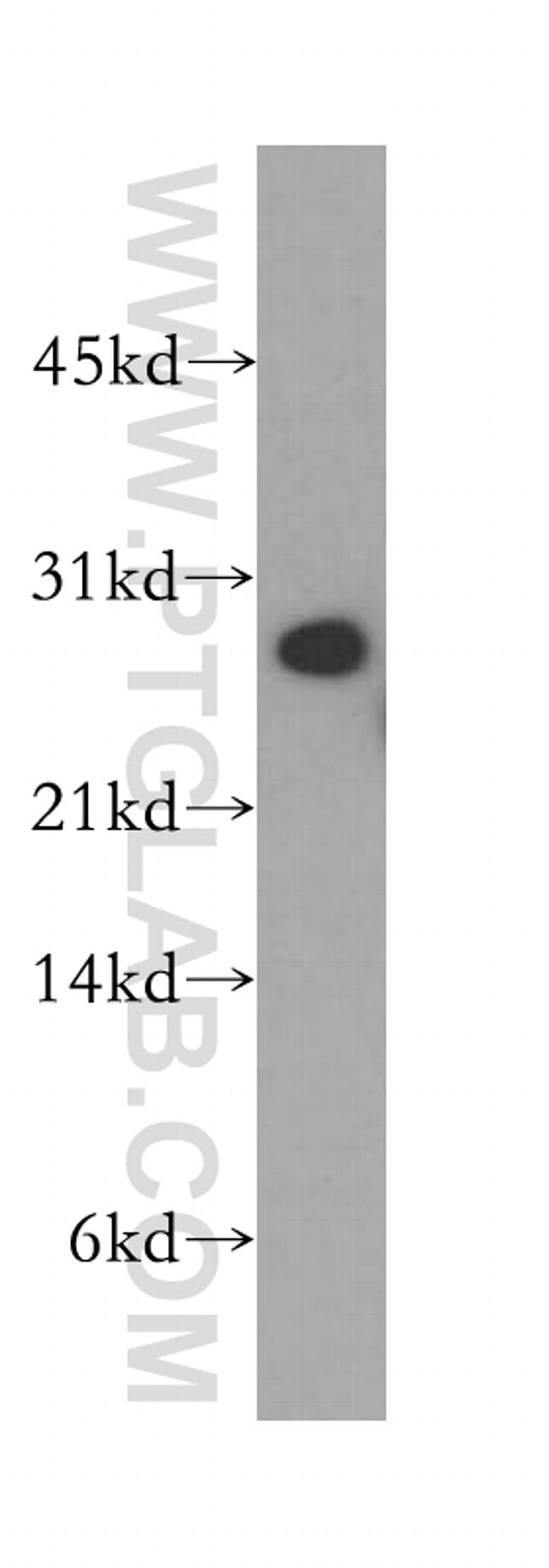 SNAP29 Antibody in Western Blot (WB)