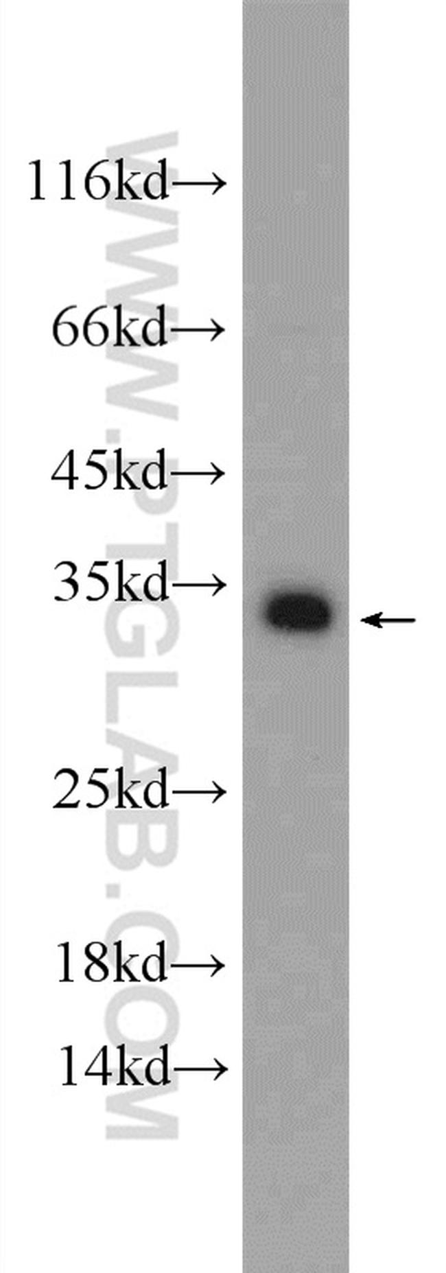 SNAP29 Antibody in Western Blot (WB)