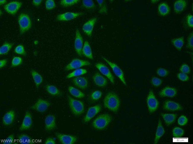 TRAM1 Antibody in Immunocytochemistry (ICC/IF)