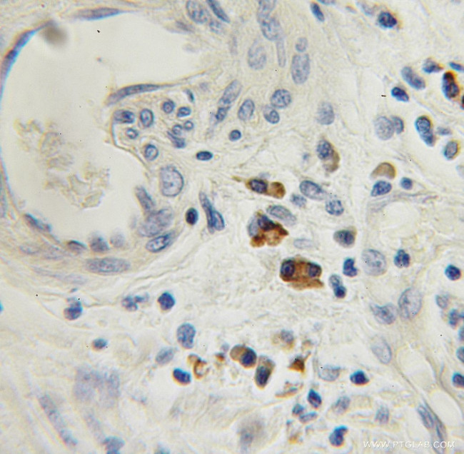 TRAM1 Antibody in Immunohistochemistry (Paraffin) (IHC (P))